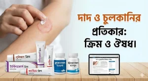 দাদ ও চুলকানি নিরাময়ে ব্যবহৃত কার্যকর ক্রিম ও ঔষধ।