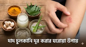 দাদ বা ফাঙ্গাল ইনফেকশন আক্রান্ত হাত এবং দাদ চুলকানি দূর করার ঘরোয়া উপায় হিসেবে ব্যবহৃত প্রাকৃতিক উপাদানের সমাহার।