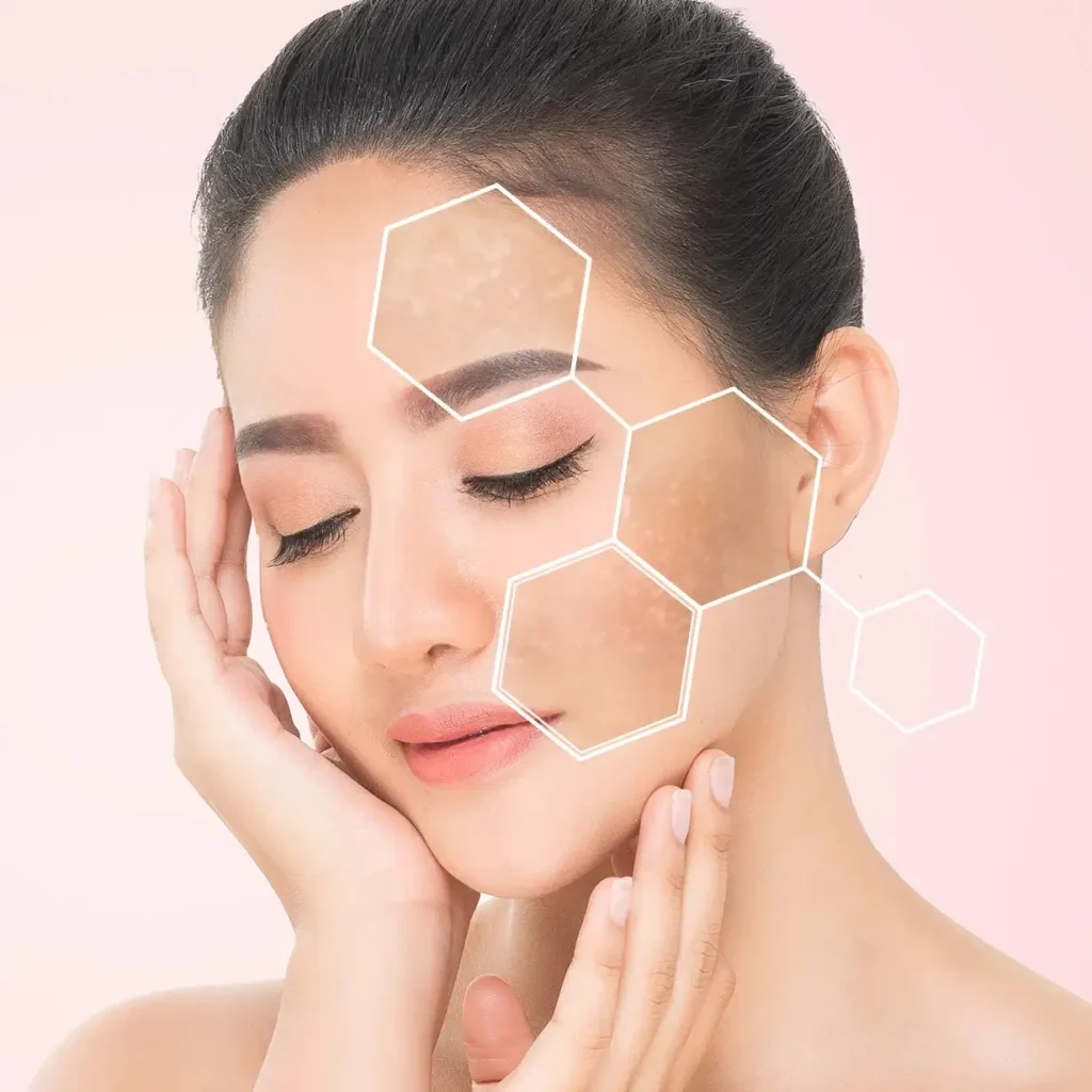 A young woman with closed eyes and hands on her face, featuring hexagonal overlays highlighting areas of skin pigmentation and dark spots.