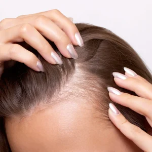 A close-up view of a person parting their hair to reveal thinning hair and a visible scalp area.