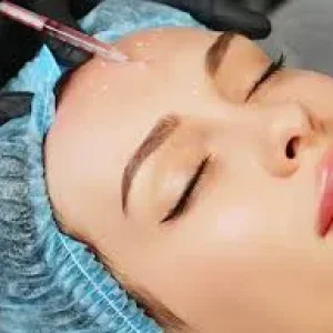 Close-up of a patient receiving a cosmetic forehead injection from a specialist wearing black medical gloves.