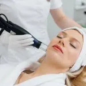 A dermatologist performing a laser skin resurfacing treatment on a patient's cheek in a clinical setting.